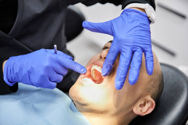 Best Broken or Cracked Tooth Emergency Dentist in Baldwyn, MS